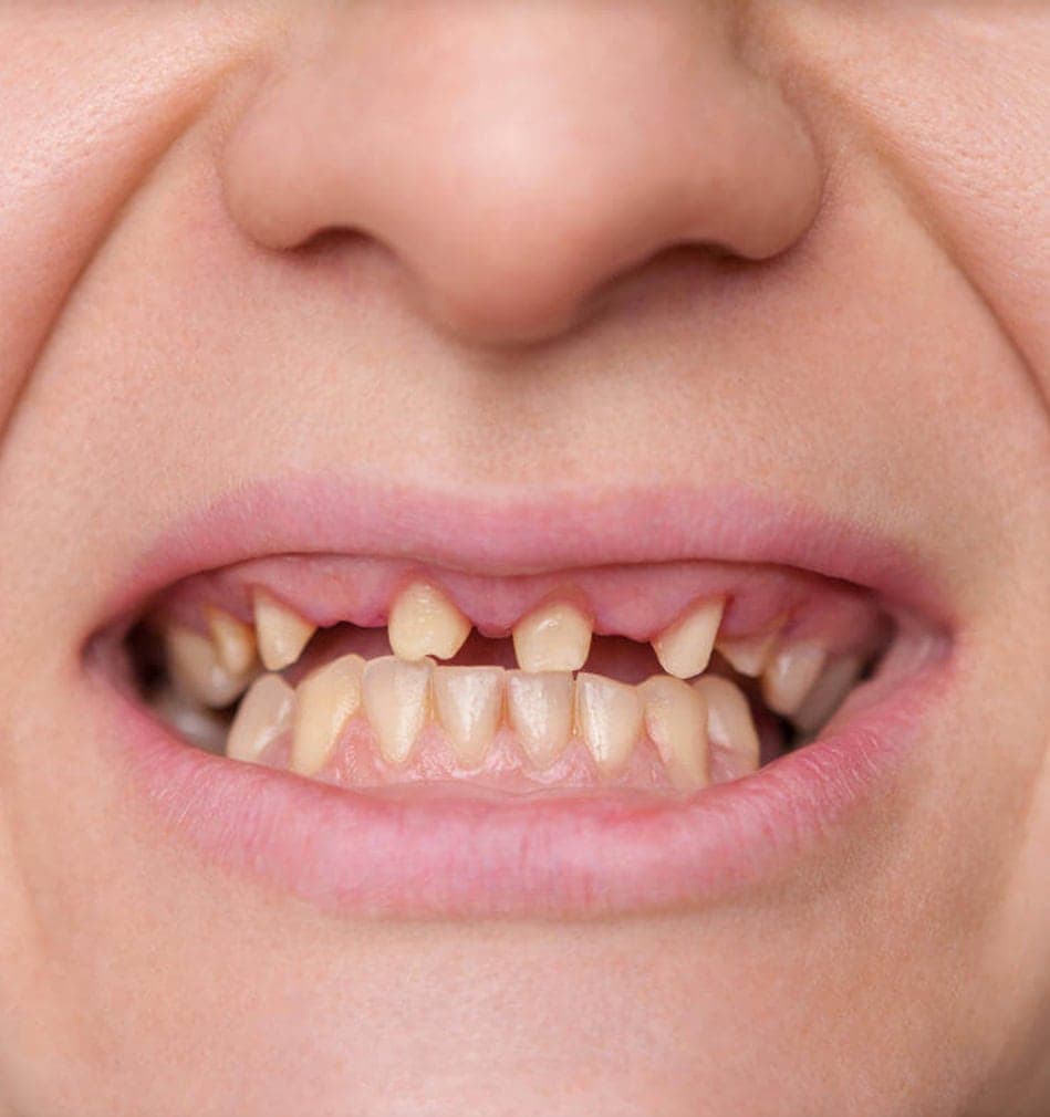 Smile before dental restoration