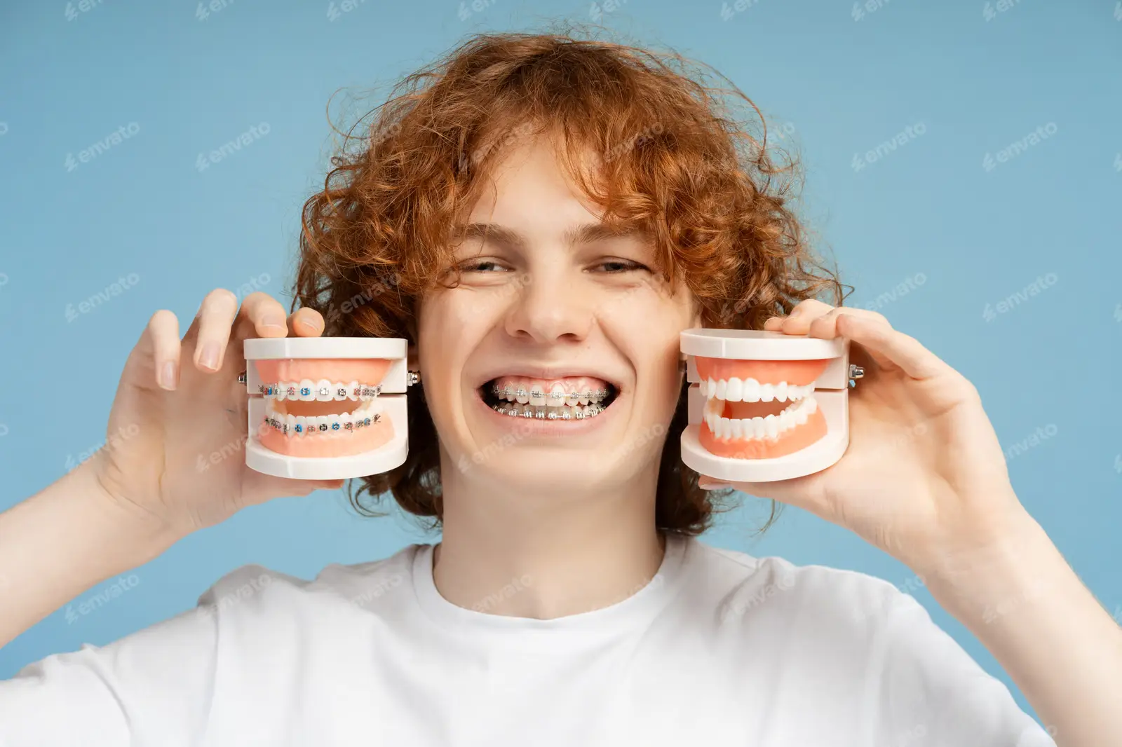 Invisalign vs. Braces: Which Is Better for Your Smile?