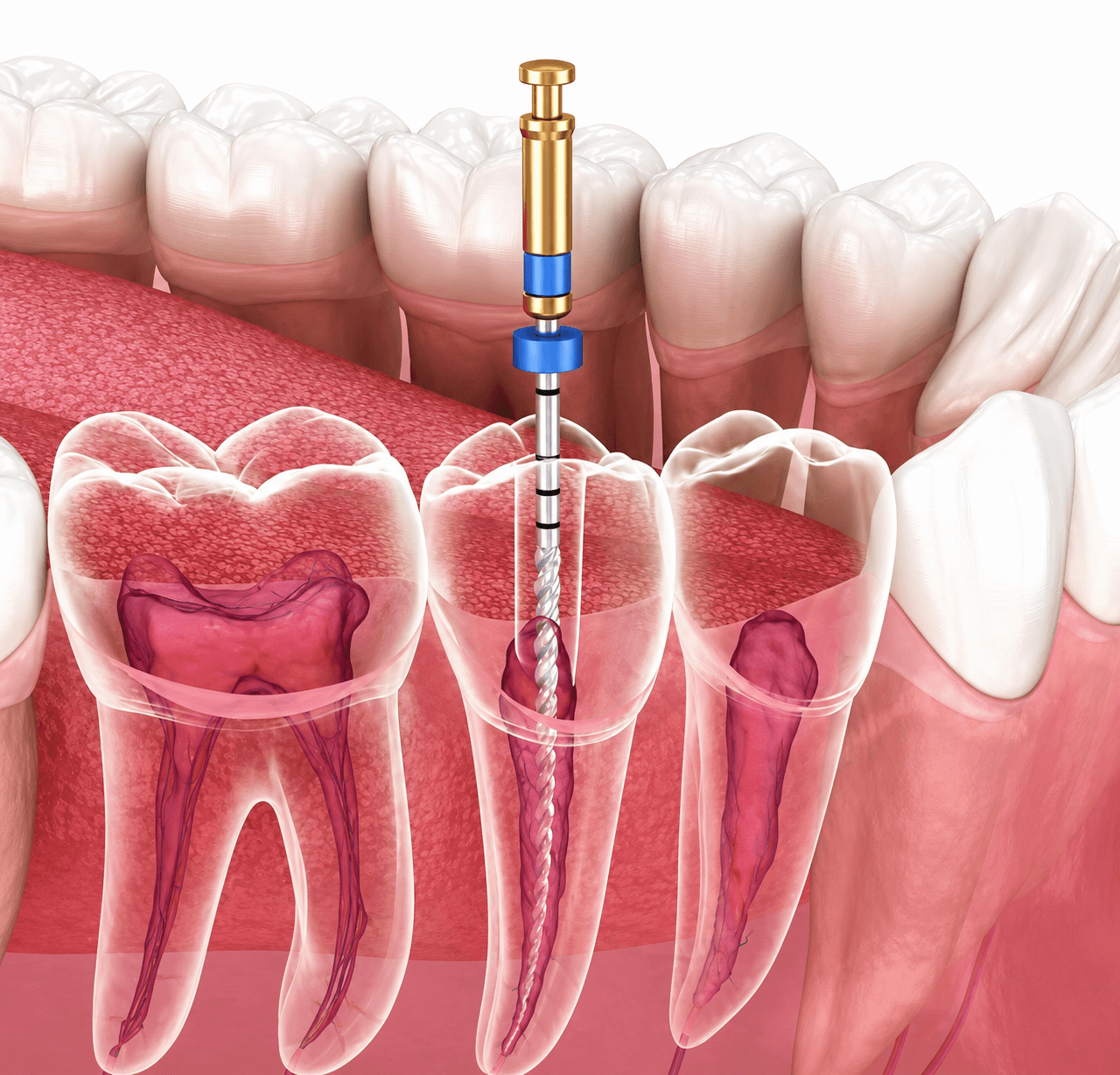 Endodontics
