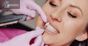 Best Dental Veneers NYC